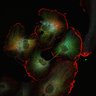 Thumbnail for ExperimentA_No01_2013_03_12_10min_actin_microtubules_vimentin_041.lsm