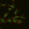 Thumbnail for ExperimentA_No09_2012_08_06_1h_actin_microtubules_048.lsm