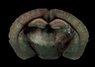 Thumbnail for Whole Brain